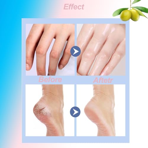 Eourhsa Crack Feet Prevention Stick, Eourhsa Foot Balm, Eoursha Crack Heel Cream -Smooth Protective BalM, Foot Balm for Dry Cracked Feet, Refreshing, Hydrating, Deep Moisturizing (Pink+Blue, one size)