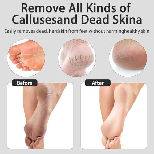 Electric Foot Callus Removers Rechargeable - Electric Foot File with 9 Adjustable Speed, 2 Grinding Heads & 30 Pcs Sandpaper Discs,Professional Foot Sander for Feet Dead Skin and Calluse (Black)