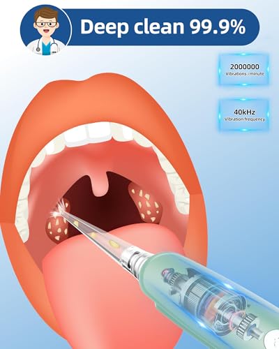 Tonsil Stone Vacuum, Tonsil Stone Remover Kit, 3X Safe Suction, 150 Degree Rotate Electronic Tonsil Stone Remover,12 in 1 Tonsil Cleaner, Oral Lamp, 5X Magnifying Mirror, Water Flosser & Syringe