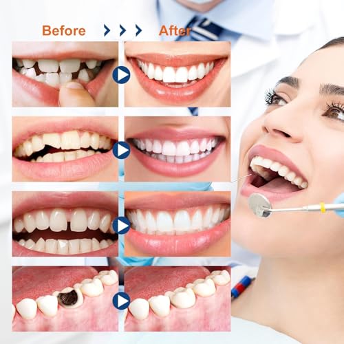 Tooth Repair Kit, Moldable Tooth Filling Repair Kit with 4 Dental Tool, Dental Care Kit Fixing The Missing and Broken Replacements, DIY Natural Filling Fake Teeth,Smile Confidently Again-8A
