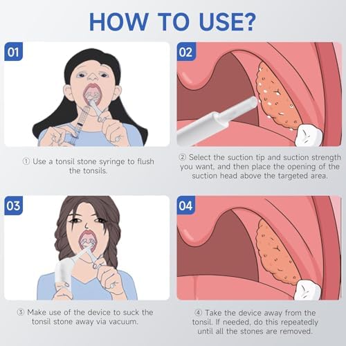 Electronic Tonsil Stone Remover, Vacuum Tonsil Stone Removal Kit with LED Light, 3 Suction Modes, Tonsil Stone Cleaner Tool,Oral Care for Mouth Health, Fight Bad Breath Instant Suction Irrigator