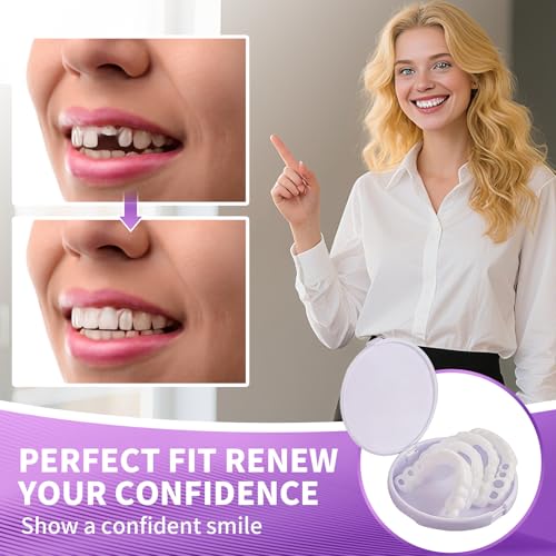 Veneers Teeth for Women and Men, Tooth Replacement Kit, Nature and Comfortable (1 Count (Pack of 1))-AA14
