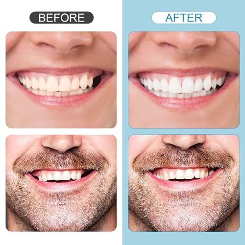 Tooth Repair Kit，Temporary Natural Shade for Filling The Gap, Moldable Thermal Beads Replacement Kit Replace The Missing or Broken Tooth-6PCS-D33
