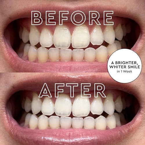 MOON Purple Toothpaste for Teeth Whitening & Enamel Protection - Hydroxyapatite Toothpaste Without Fluoride - Color-Correcting Formula for Long-Term Whitening - Neutralize Stains - Mint (4.2 Oz)
